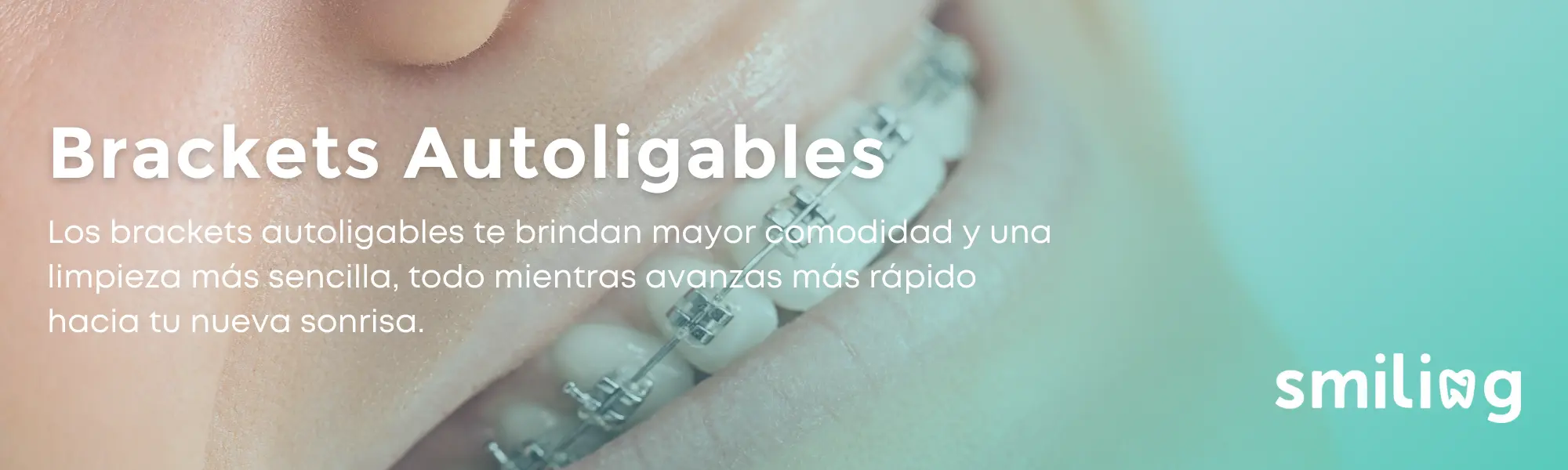 Brackets Autoligables