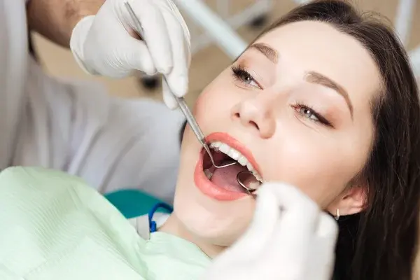 Tipos de caries