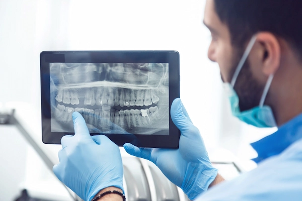 dentista escaneando diente roto