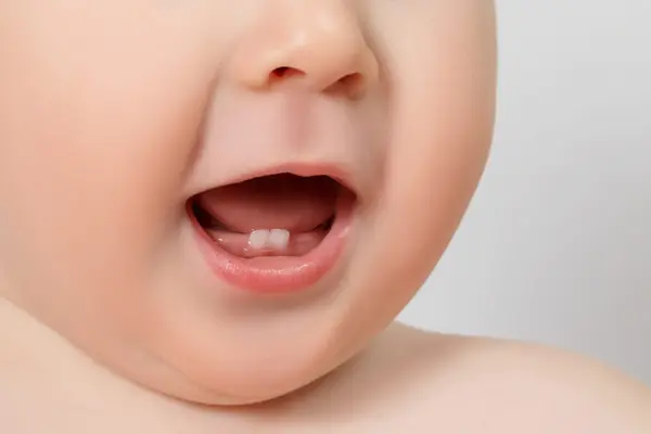 Qué es la erupción dental