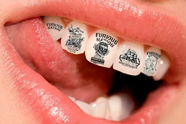 7 modas dentales peligrosas