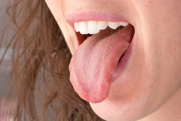 5 colores de la lengua y su significado