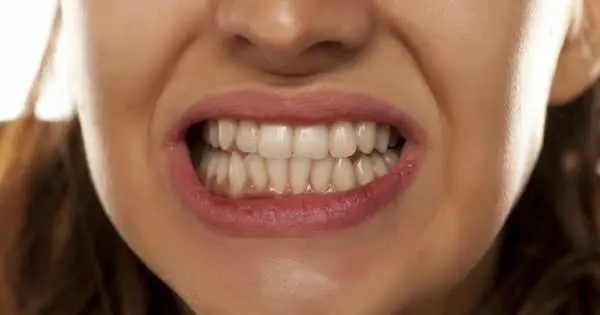 Causas por las que rechinas los dientes