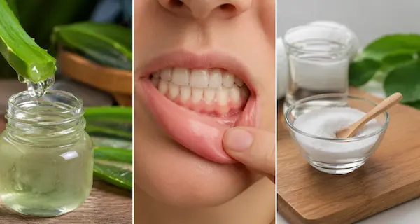 Remedios para las encías inflamadas que pueden ayudar en casa