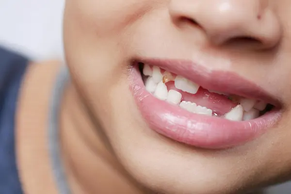 dolor en los dientes