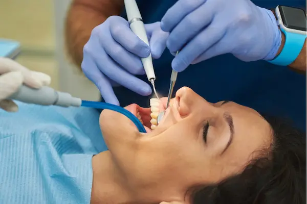 Destartraje-supragingival