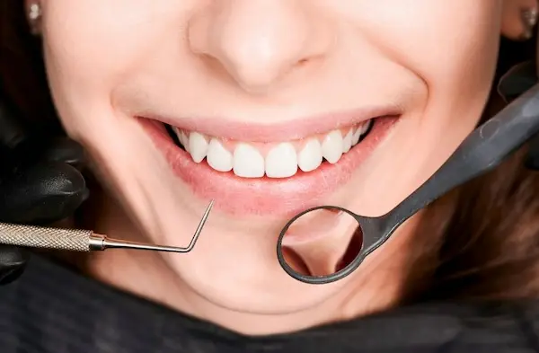 Cómo prevenir la transparencia en los dientes