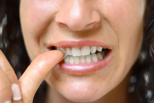 Golpes, fisuras y microfracturas dentales
